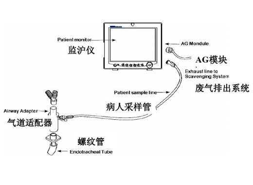 先鋒科技探測器、光學元件為麻醉氣體濃度監測提供解決方案